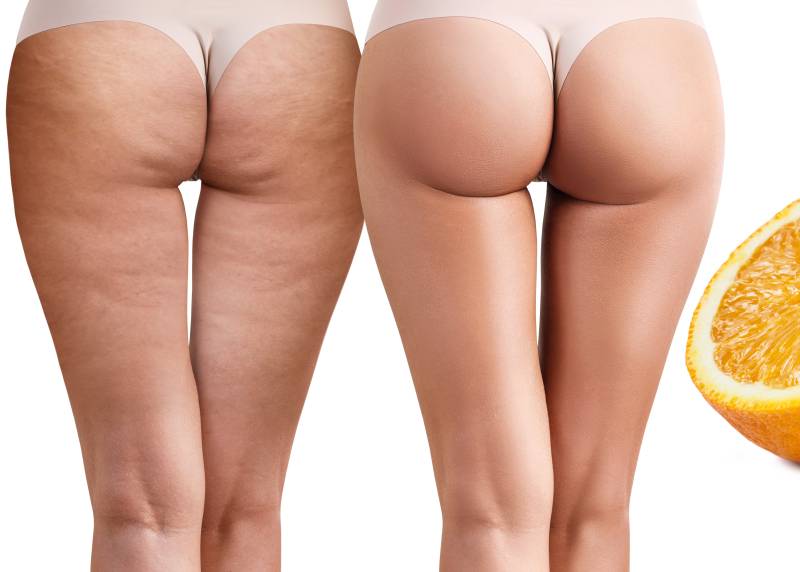 La pressothérapie pour des soins Minceurs efficaces à Aix en Provence est elle un soin remboursée par la sécurité sociale ?